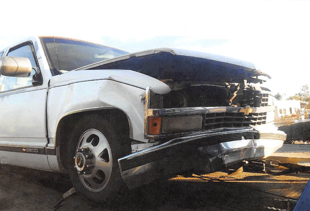 Traumatic Brain Injury with eye injury